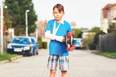 Boy with skateboard and broken arm